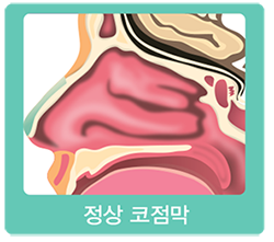 정상 코점막